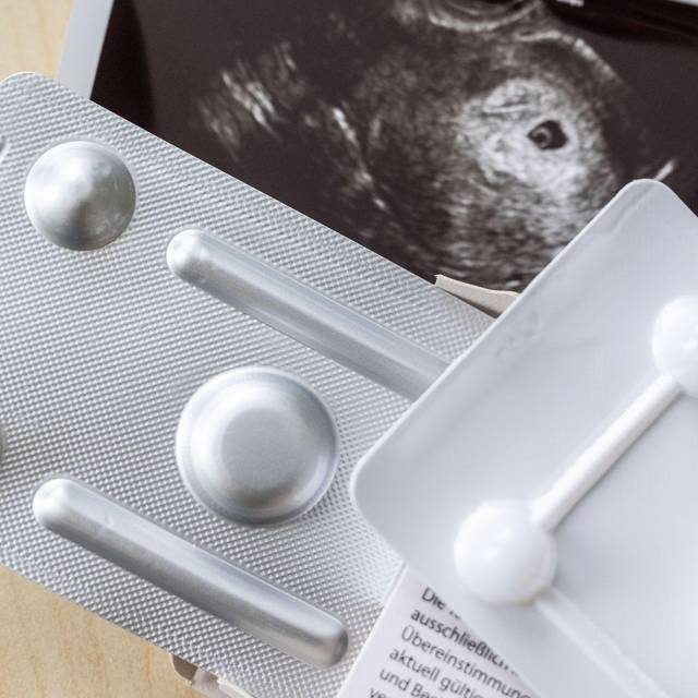 Schwangerschaftsabbruch in Frauenarztpraxis