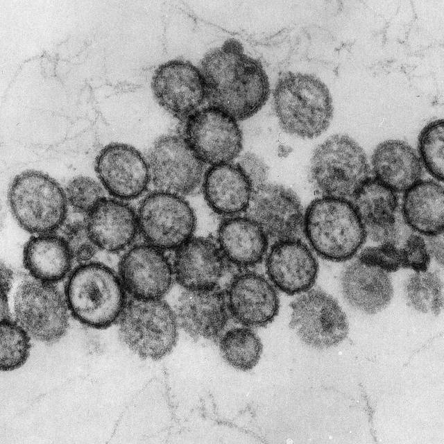 Hantavirus