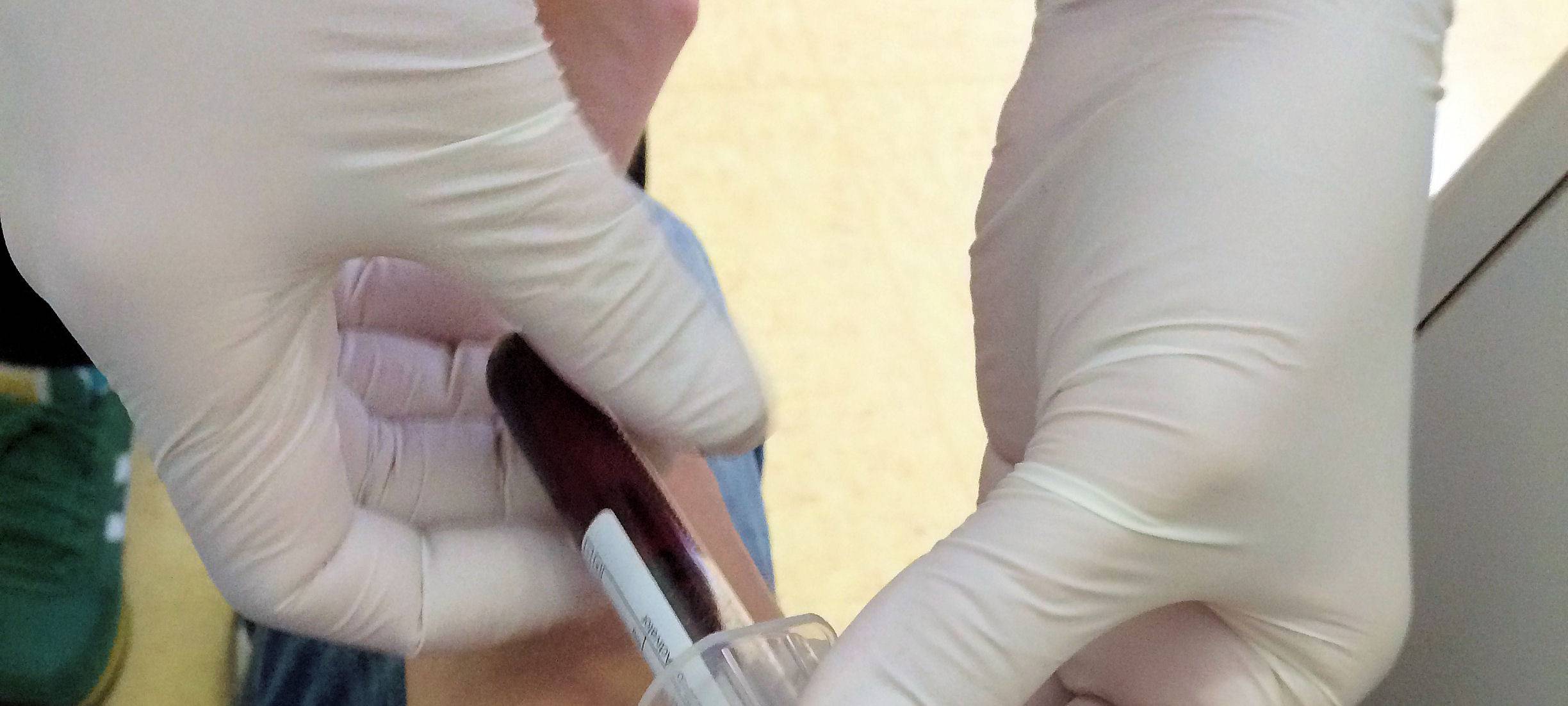 Bluttests bei Schülern und Lehrern